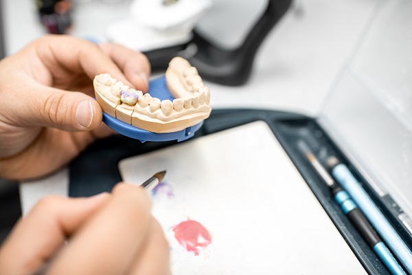 O que é restauração dentária e quando ela deve ser feita?