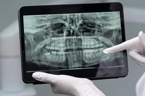Radiografias Odontológicas: Um Guia Completo