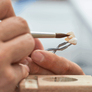 restaurações dentárias