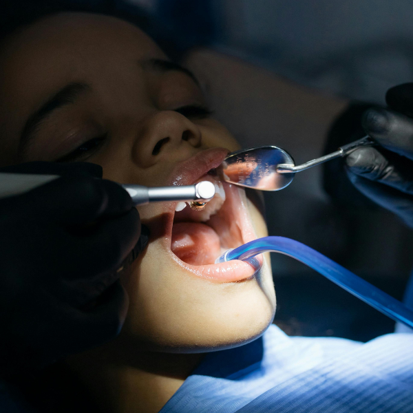 Cárie Dentária em Crianças