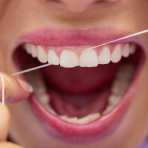Fio dental