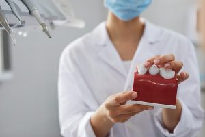 Os perigos da periodontite