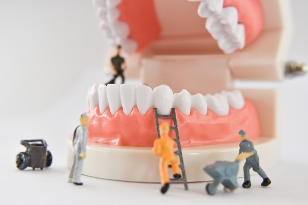 A periodontite e suas causas