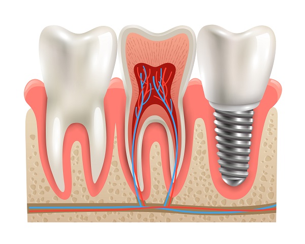 O que faz o profissional de endodontia: descubra