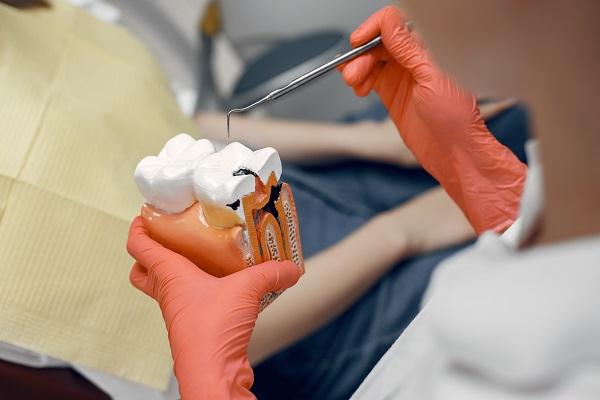 O que é Tratamento de canal dentário