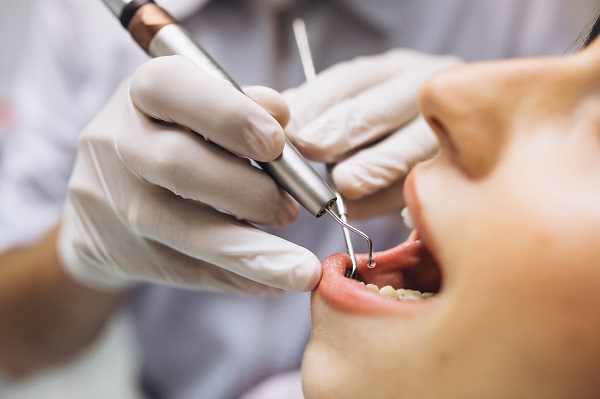 O que é Tratamento de canal dentário: saiba
