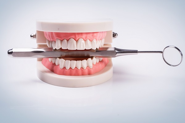 4 benefícios de próteses dentárias: saiba