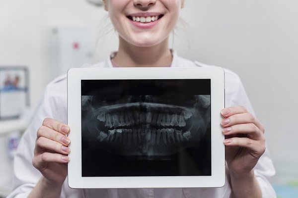 Tipos de radiografia odontológica: descubra