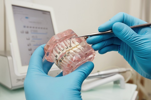 Principais tendências da ortodontia em 2023: descubra