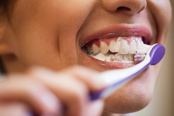 4 cuidados dentários que você precisa ter: saiba agora