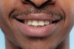 5 Dicas para Prevenir Manchas nos Dentes