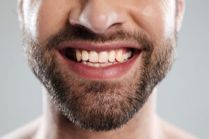 Como identificar a Falta de Cálcio nos Dentes?
